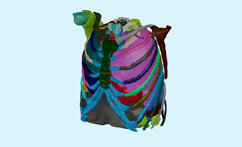 MD Forge 3D CT Segmentation